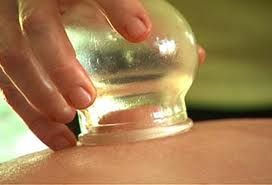 Cupping2 (1)